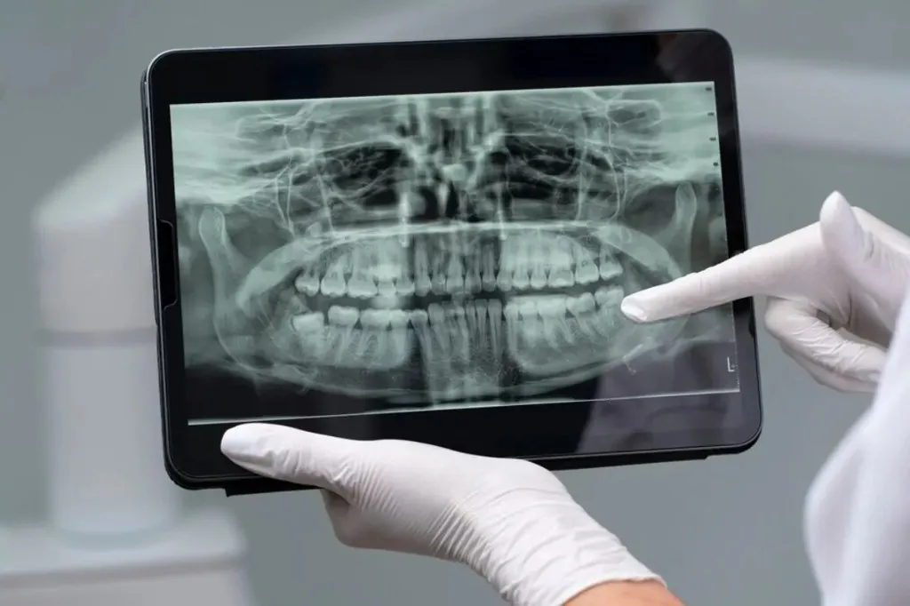 Diş implantı muayenesi ve dijital planlama